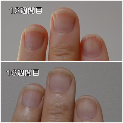 １２週間目と16週間目の爪を比較